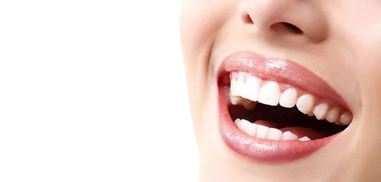 cosmetisch-tandheelkunde-lach-wit-gebit